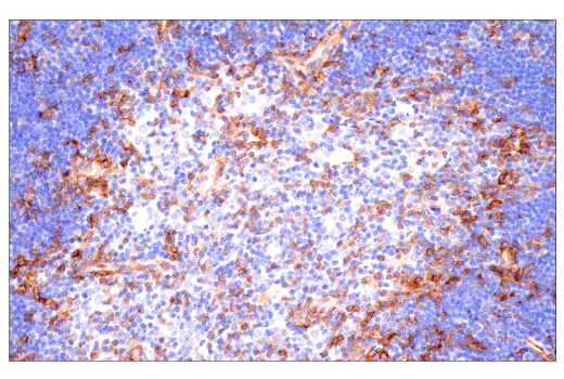 Immunohistochemistry Image 6: CD38 (E9F5A) XP® Rabbit mAb