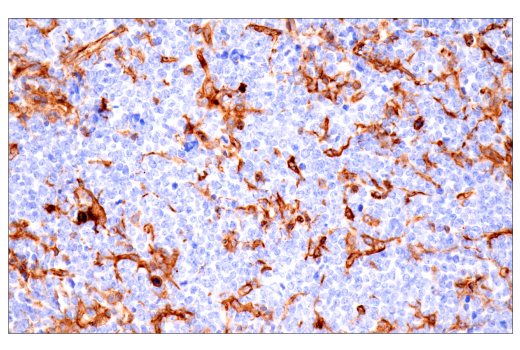 Immunohistochemistry Image 4: CD38 (E9F5A) XP® Rabbit mAb