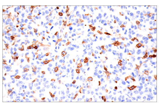 Immunohistochemistry Image 3: CD38 (E9F5A) XP® Rabbit mAb