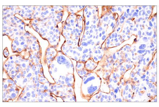 Immunohistochemistry Image 2: CD38 (E9F5A) XP® Rabbit mAb