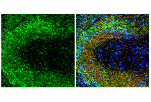 Immunofluorescence Image 1: CD38 (E9F5A) XP® Rabbit mAb