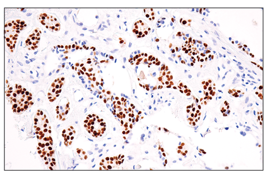 Immunohistochemistry Image 1: Sox10 (E6B6I) XP® Rabbit mAb