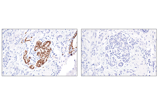 Immunohistochemistry Image 2: Sox10 (E6B6I) XP® Rabbit mAb