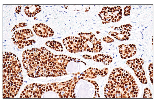 Immunohistochemistry Image 3: Sox10 (E6B6I) XP® Rabbit mAb