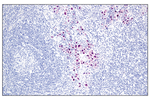 Immunohistochemistry Image 4: Sox10 (E6B6I) XP® Rabbit mAb