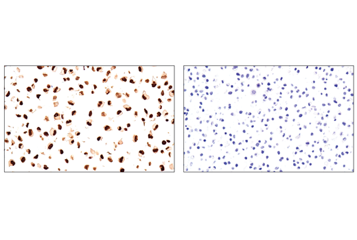 Immunohistochemistry Image 5: Sox10 (E6B6I) XP® Rabbit mAb