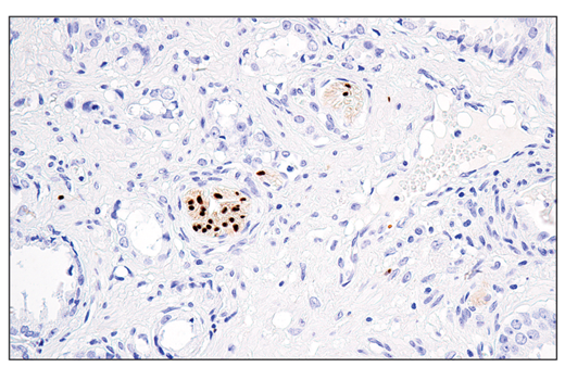 Immunohistochemistry Image 6: Sox10 (E6B6I) XP® Rabbit mAb