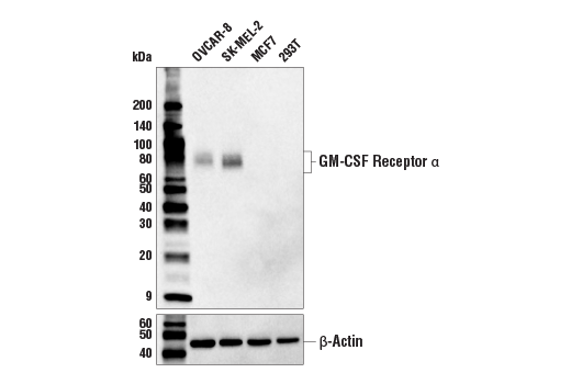 Western Blotting Image 1: GM-CSF Receptor α (E8Z3S) Rabbit mAb