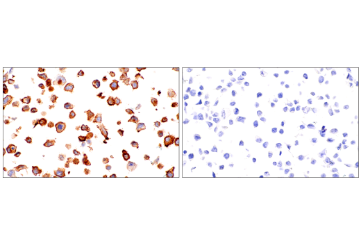 Immunohistochemistry Image 10: GM-CSF Receptor α (E8Z3S) Rabbit mAb