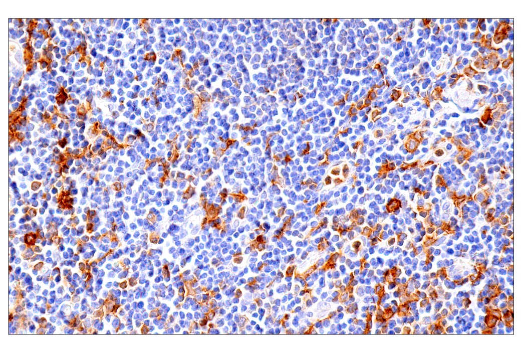 Immunohistochemistry Image 12: GM-CSF Receptor α (E8Z3S) Rabbit mAb