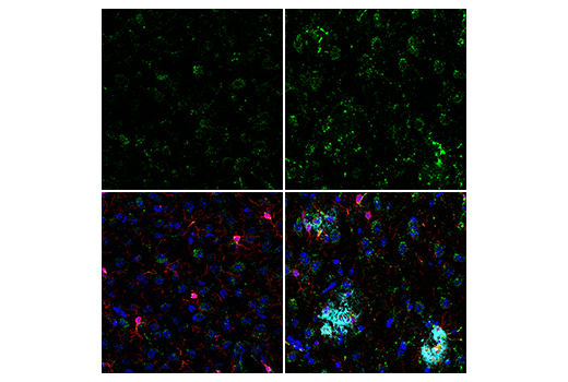  Image 15: Mouse Reactive Alzheimer's Disease Model Microglia Phenotyping IF Antibody Sampler Kit