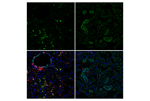  Image 24: Mouse Reactive Alzheimer's Disease Model Microglia Phenotyping IF Antibody Sampler Kit