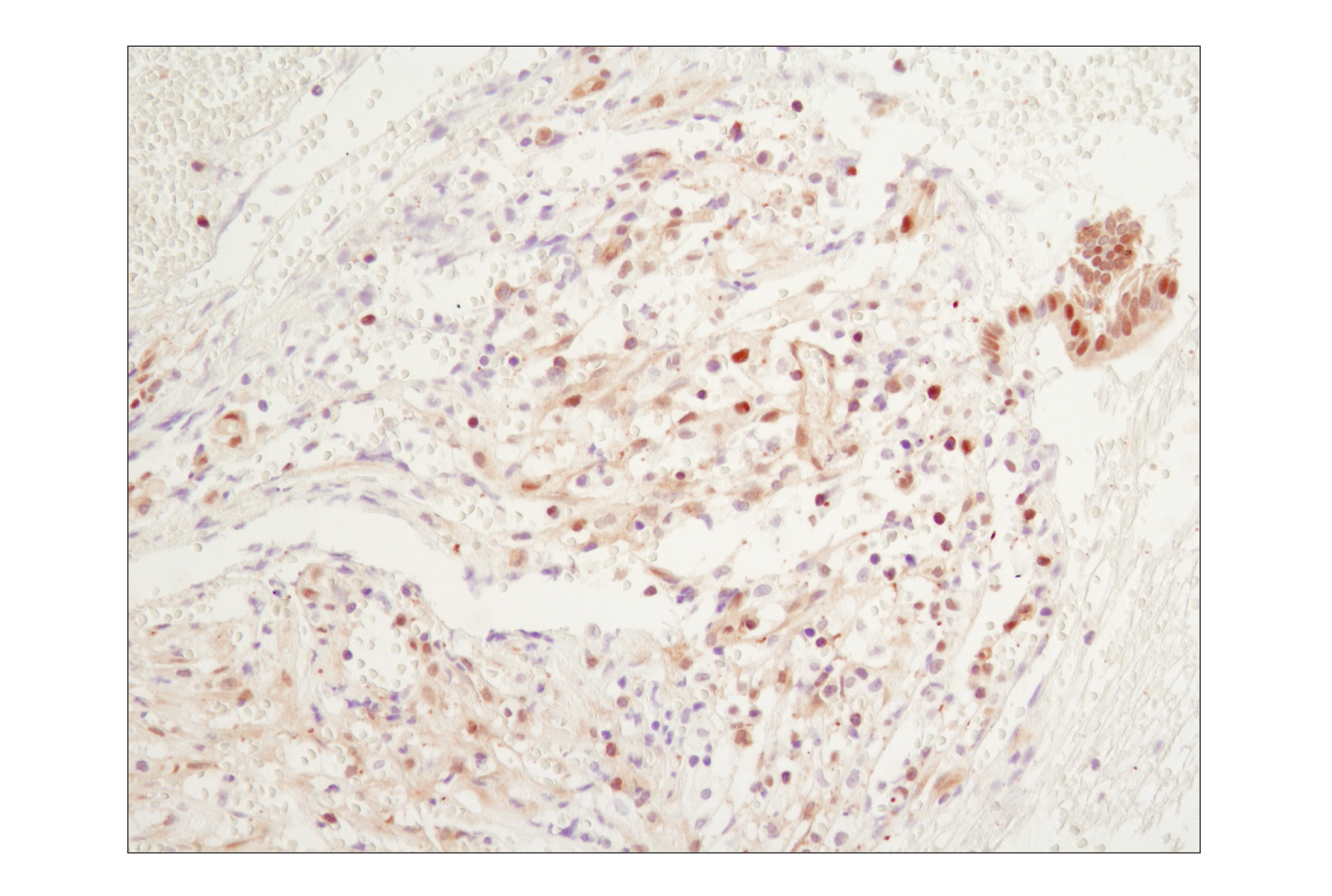 Immunohistochemistry Image 1: NF-κB p65 (D14E12) XP® Rabbit mAb (BSA and Azide Free)