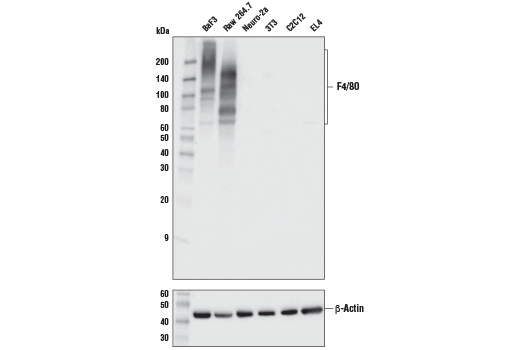  Image 8: Mouse Reactive M1 vs M2 Macrophage IHC Antibody Sampler Kit