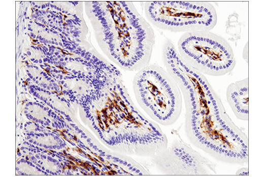  Image 30: Mouse Reactive M1 vs M2 Macrophage IHC Antibody Sampler Kit