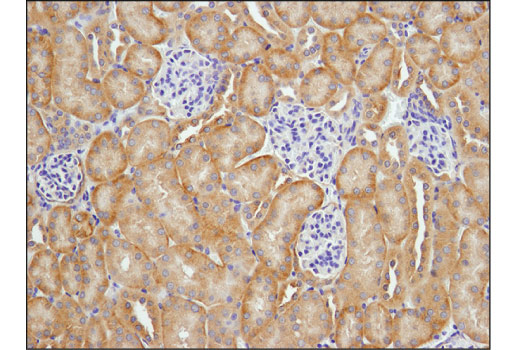 Immunohistochemistry Image 2: EGF Receptor (D1P9C) Rabbit mAb