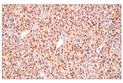 Immunohistochemistry Image 10: CRBN (D8H3S) Rabbit mAb