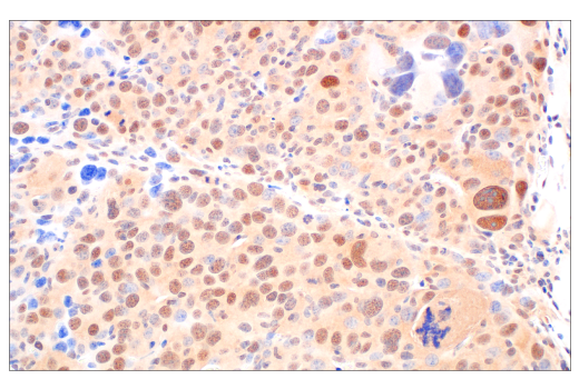  Image 30: PROTAC E3 Ligase Profiling Antibody Sampler Kit