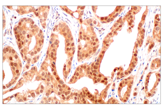 Immunohistochemistry Image 2: CRBN (D8H3S) Rabbit mAb