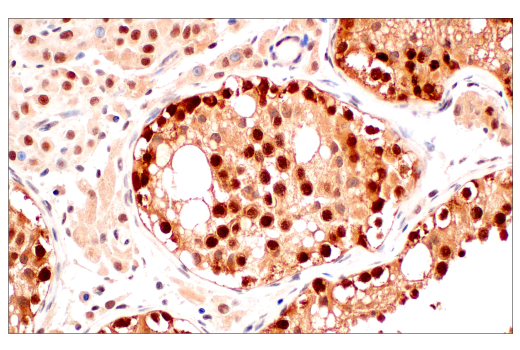 Immunohistochemistry Image 8: CRBN (D8H3S) Rabbit mAb