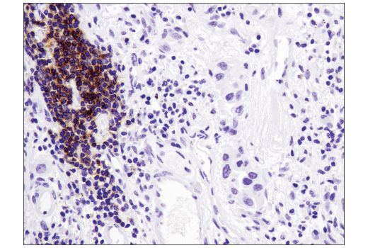 Immunohistochemistry Image 4: CXCR5 (D6L3C) Rabbit mAb