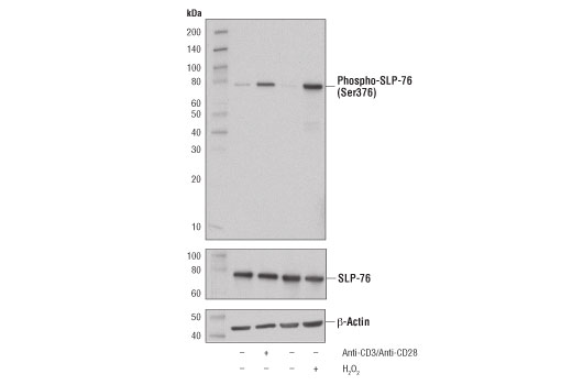 Western Blotting Image 1: Phospho-SLP-76 (Ser376) (D7S1K) Rabbit mAb (BSA and Azide Free)