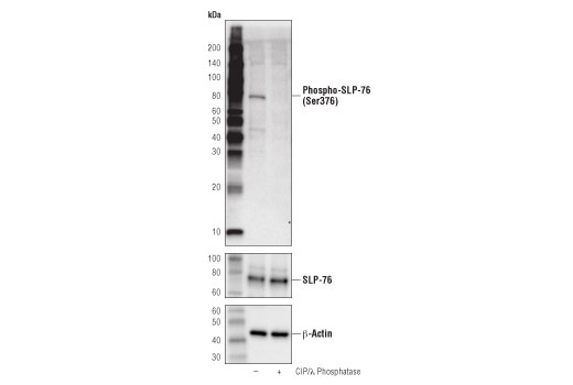 Western Blotting Image 2: Phospho-SLP-76 (Ser376) (D7S1K) Rabbit mAb (BSA and Azide Free)