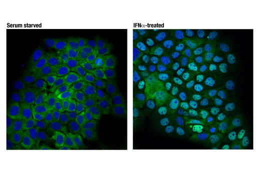 Image 30: IFN (Type I/III) Signaling Pathway Antibody Sampler Kit