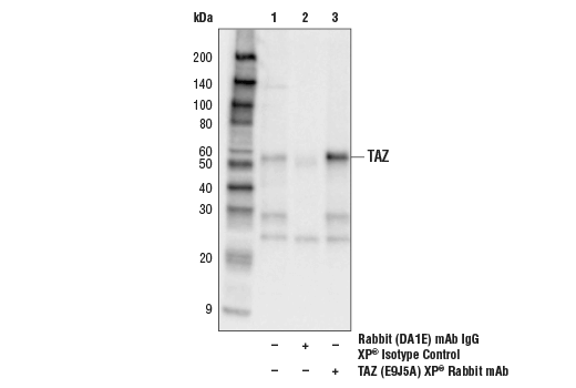 Immunoprecipitation Image 1: TAZ (E9J5A) XP® Rabbit mAb