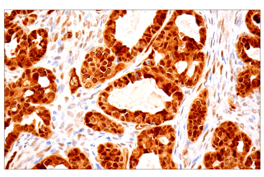 Immunohistochemistry Image 1: TAZ (E9J5A) XP® Rabbit mAb