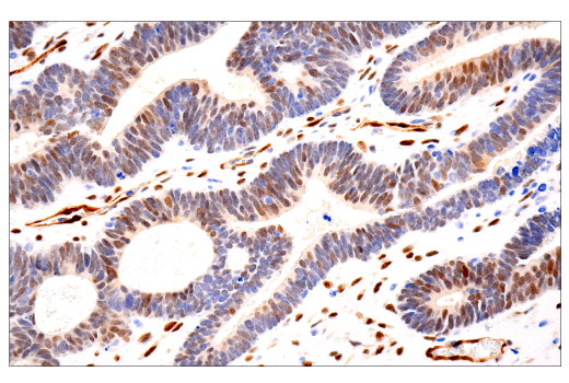 Immunohistochemistry Image 2: TAZ (E9J5A) XP® Rabbit mAb