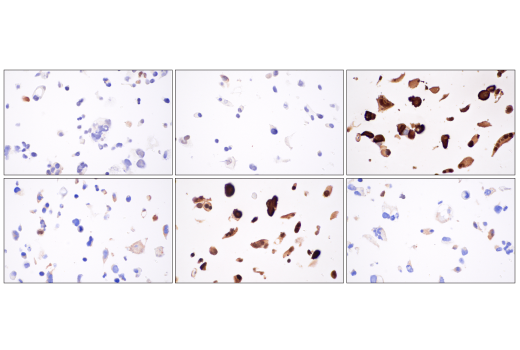 Immunohistochemistry Image 3: TAZ (E9J5A) XP® Rabbit mAb