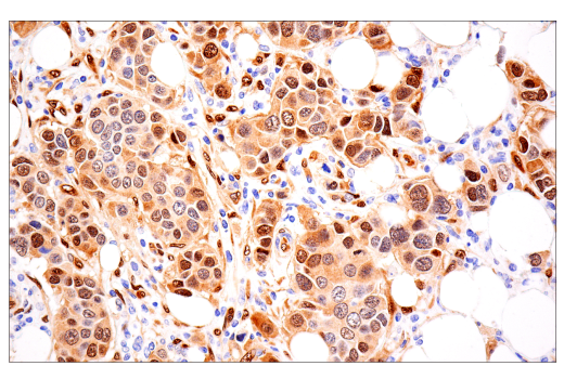 Immunohistochemistry Image 4: TAZ (E9J5A) XP® Rabbit mAb