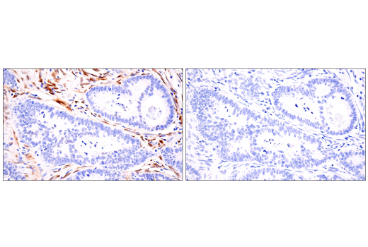 Immunohistochemistry Image 5: TAZ (E9J5A) XP® Rabbit mAb