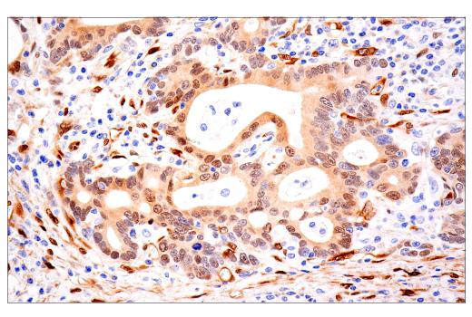 Immunohistochemistry Image 6: TAZ (E9J5A) XP® Rabbit mAb