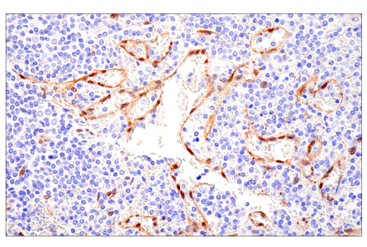 Immunohistochemistry Image 7: TAZ (E9J5A) XP® Rabbit mAb