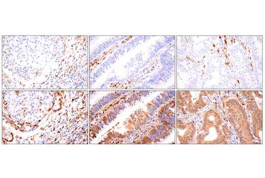 Immunohistochemistry Image 8: TAZ (E9J5A) XP® Rabbit mAb