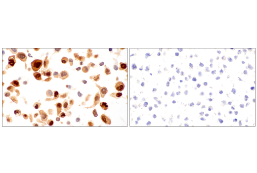 Immunohistochemistry Image 9: TAZ (E9J5A) XP® Rabbit mAb