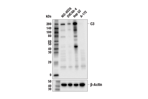 Western Blotting Image 1: Complement C3 (E4D2Z) Rabbit mAb