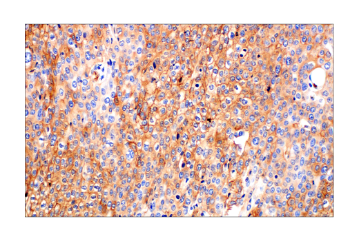  Image 67: Hypoxia Activation IHC Antibody Sampler Kit