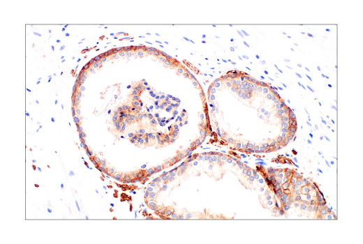  Image 85: Hypoxia Activation IHC Antibody Sampler Kit