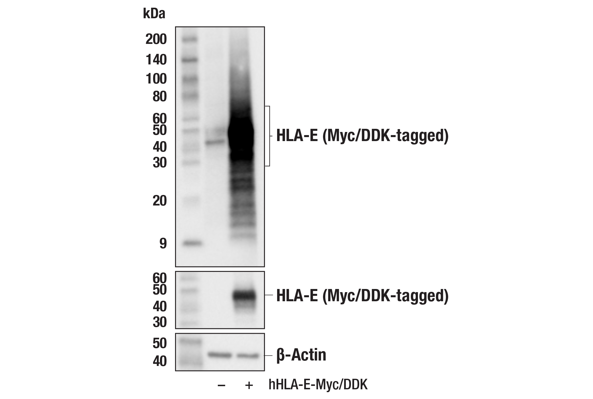 Western Blotting Image 2: HLA-E (MEM-E/02) Mouse mAb