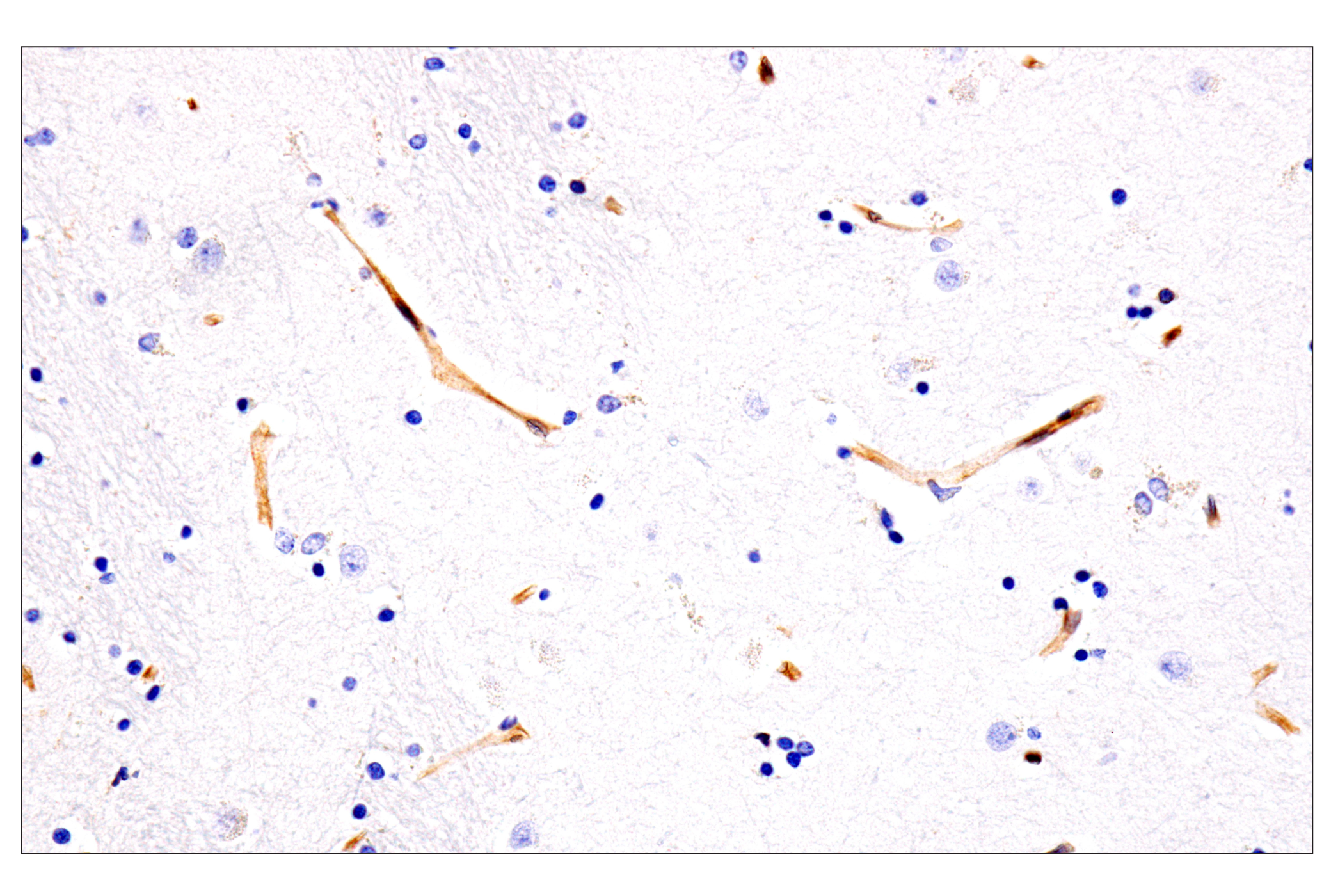 Immunohistochemistry Image 13: HLA-E (MEM-E/02) Mouse mAb