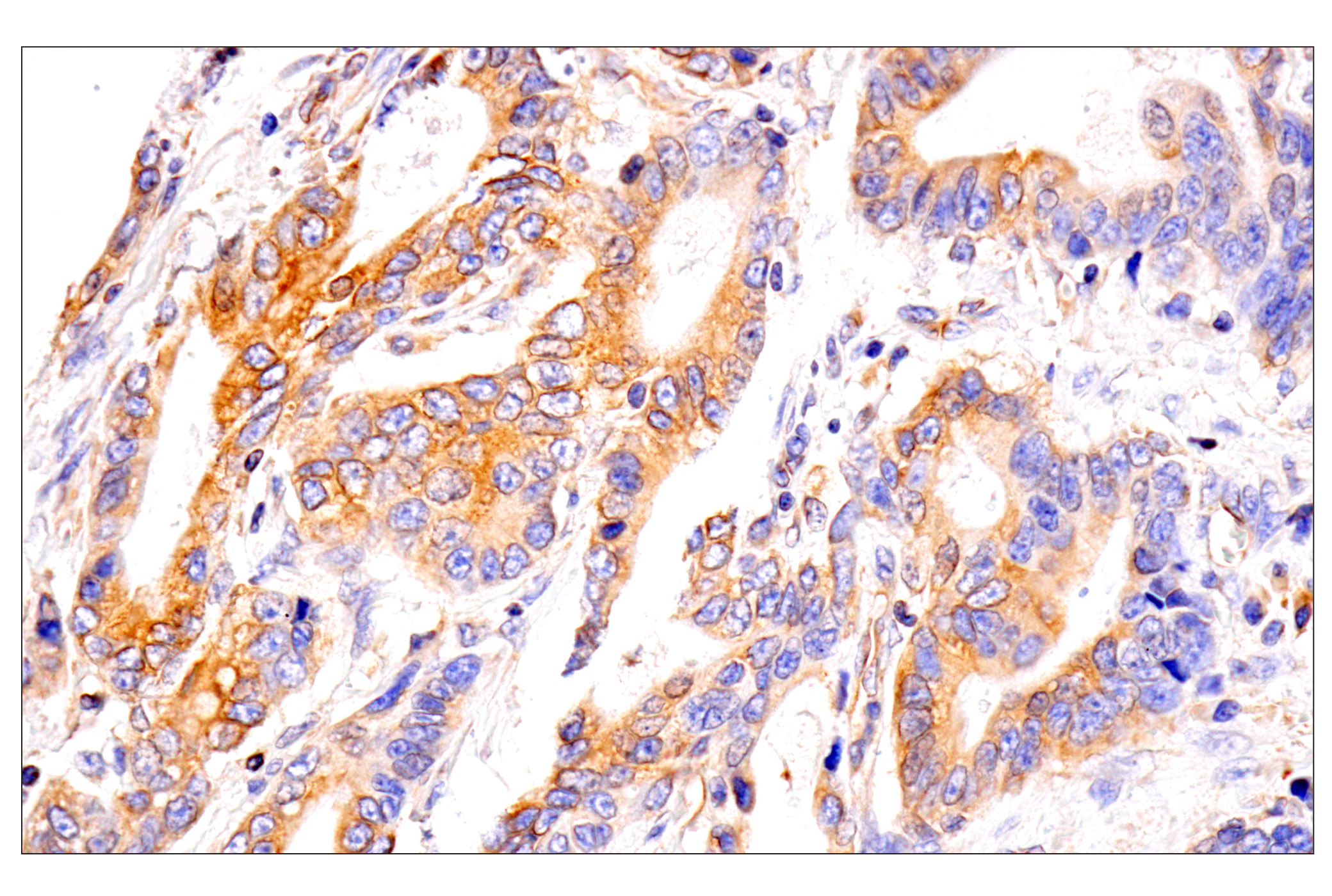 Immunohistochemistry Image 18: HLA-E (MEM-E/02) Mouse mAb