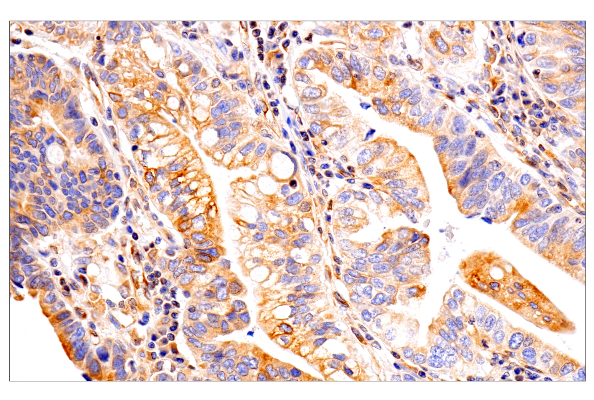 Immunohistochemistry Image 17: HLA-E (MEM-E/02) Mouse mAb