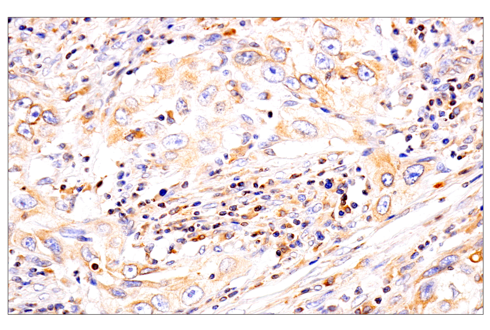 Immunohistochemistry Image 16: HLA-E (MEM-E/02) Mouse mAb