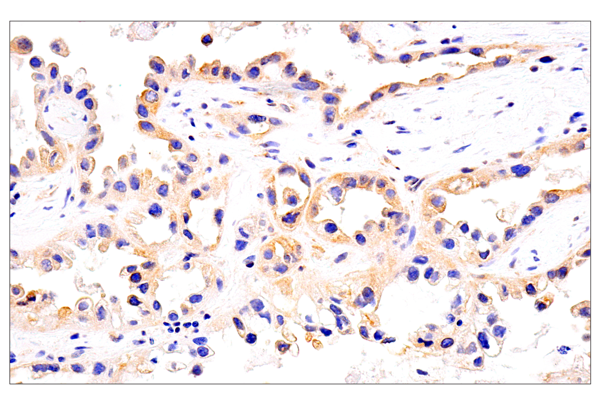 Immunohistochemistry Image 15: HLA-E (MEM-E/02) Mouse mAb