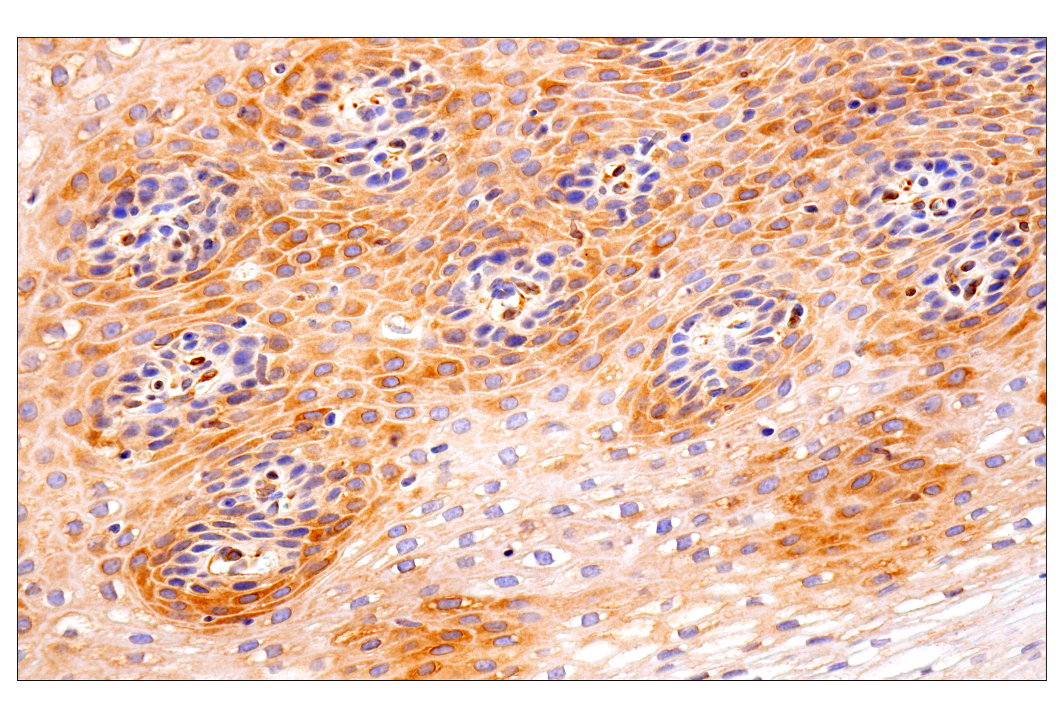 Immunohistochemistry Image 12: HLA-E (MEM-E/02) Mouse mAb