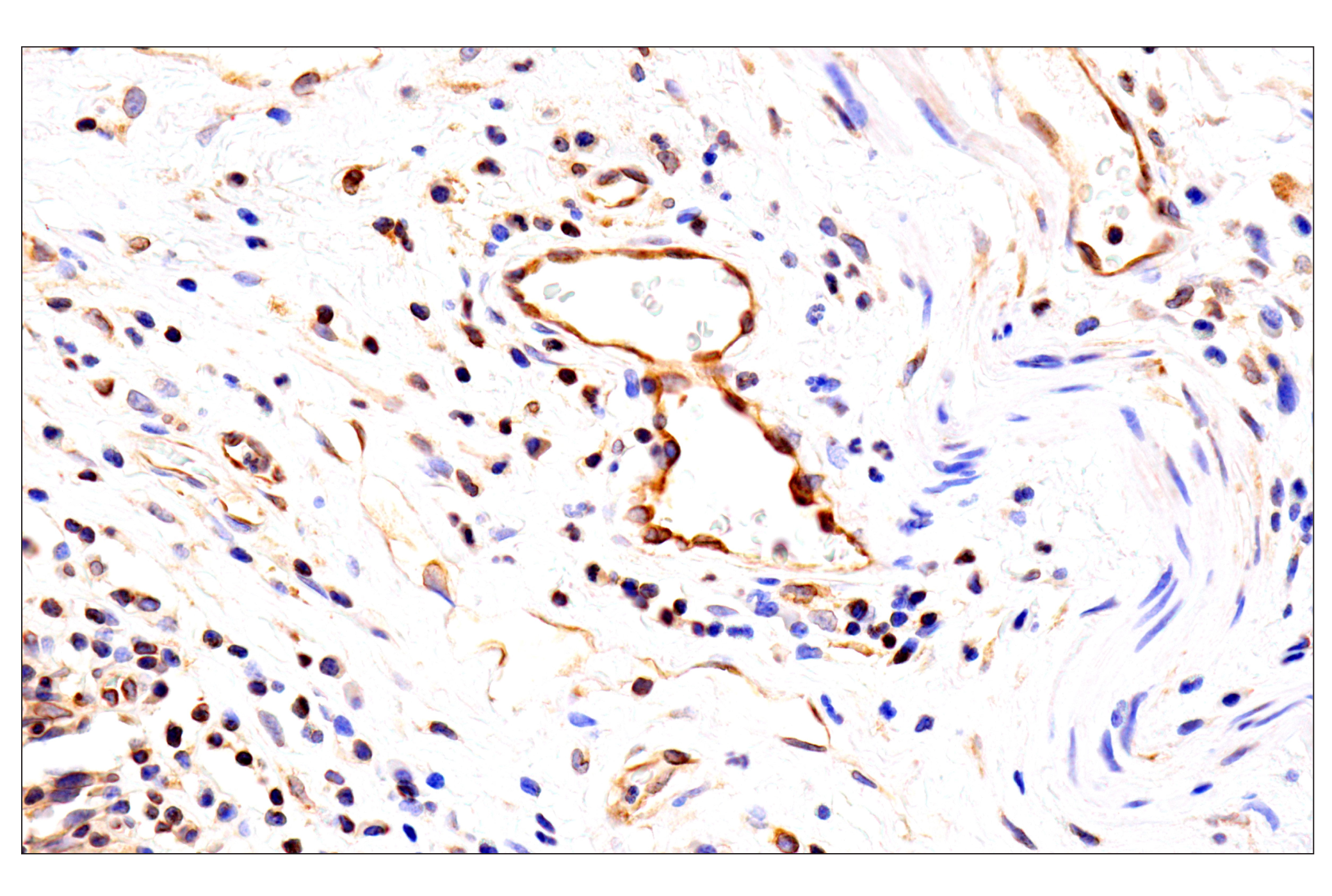 Immunohistochemistry Image 11: HLA-E (MEM-E/02) Mouse mAb