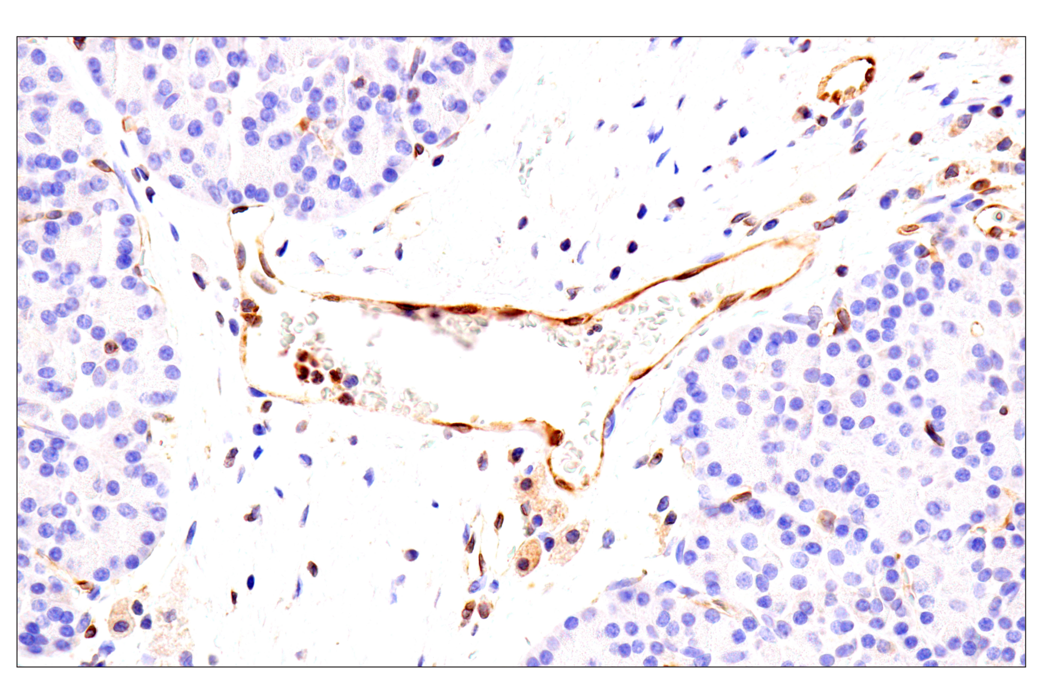 Immunohistochemistry Image 8: HLA-E (MEM-E/02) Mouse mAb